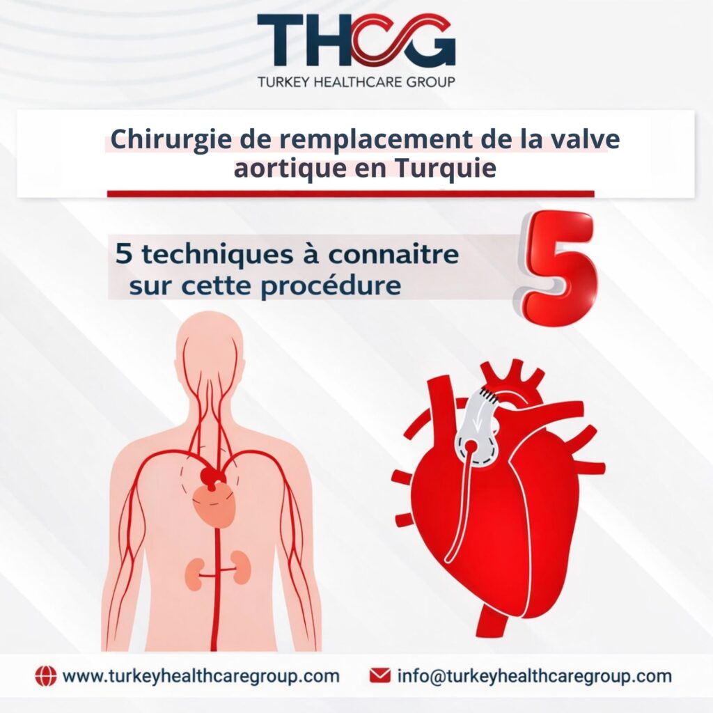 Remplacement de la valve aortique en Turquie